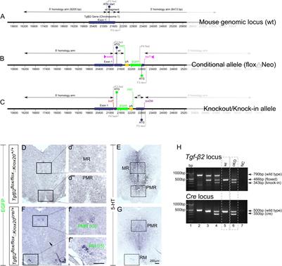 Spatiotemporal Role of Transforming Growth Factor Beta 2 in Developing and Mature Mouse Hindbrain Serotonergic Neurons